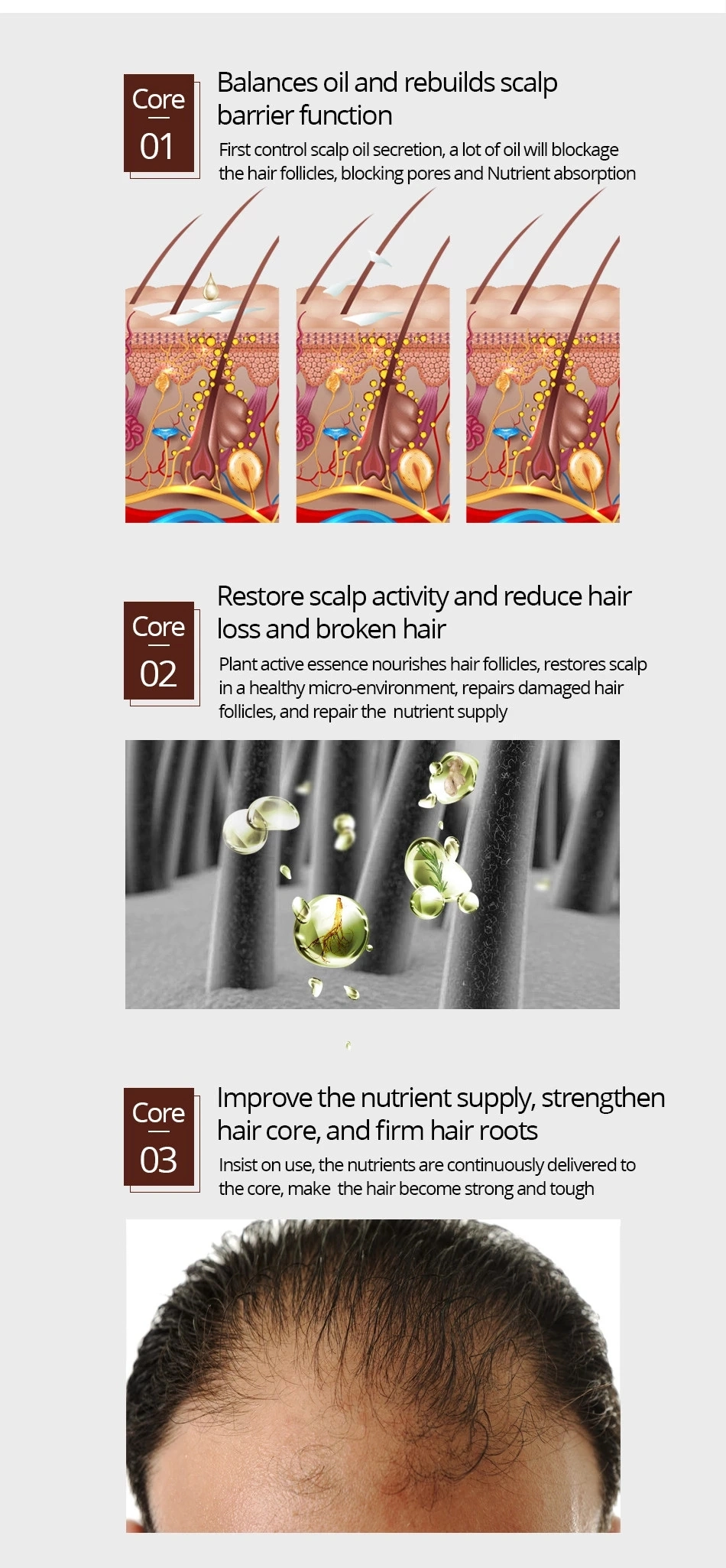 OEM Hair Growth Essential Oil Plant Essence Prevents Hair Loss Nourishing Rapid Hair Growth Suitable Men Women