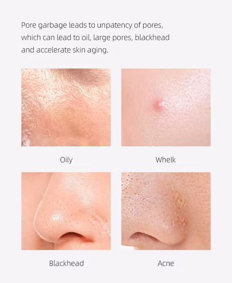 2023 New Face Face Ultrasonic Skin Scrubber Skin Scrubber Skin Care