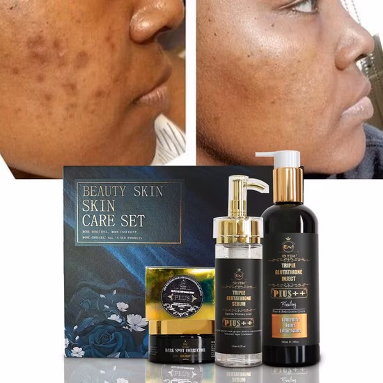 Amazon Best Selling Ailke 7 Days Whitening Cream Remove Dark Spots-Glutathione Serum Skin Care Set